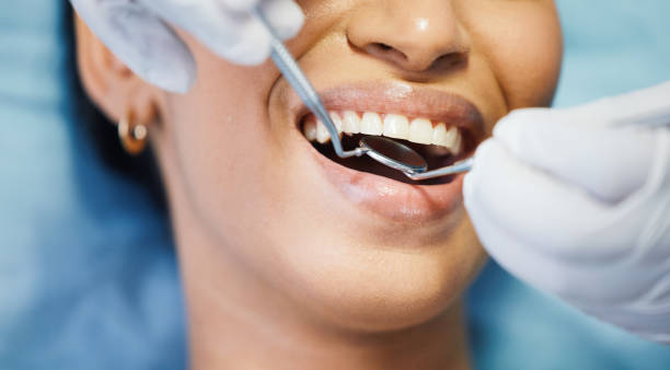 Best Walk-In Emergency Dentist in Fort Madison, IA